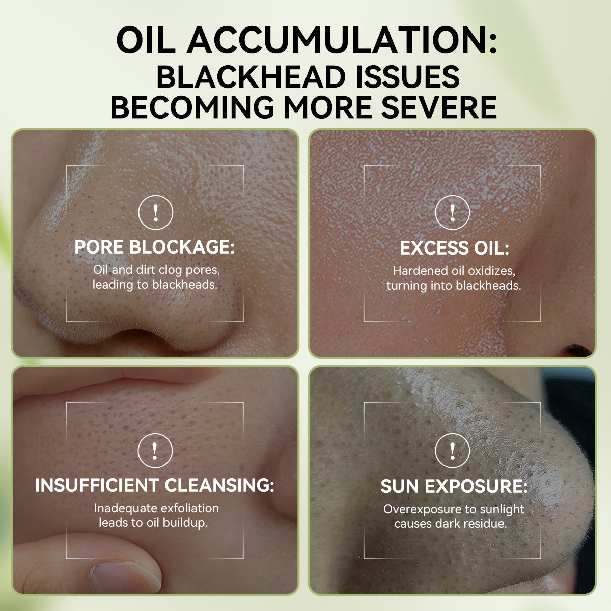 Upgraded 2.0 Bamboo Charcoal Blackhead Remover Mask