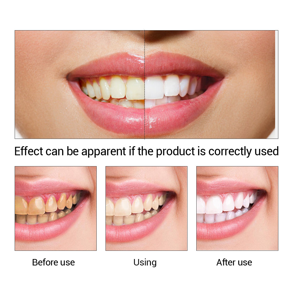 LANBENA Teeth Whitening Essence