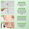 Precision Acne Spot Serum