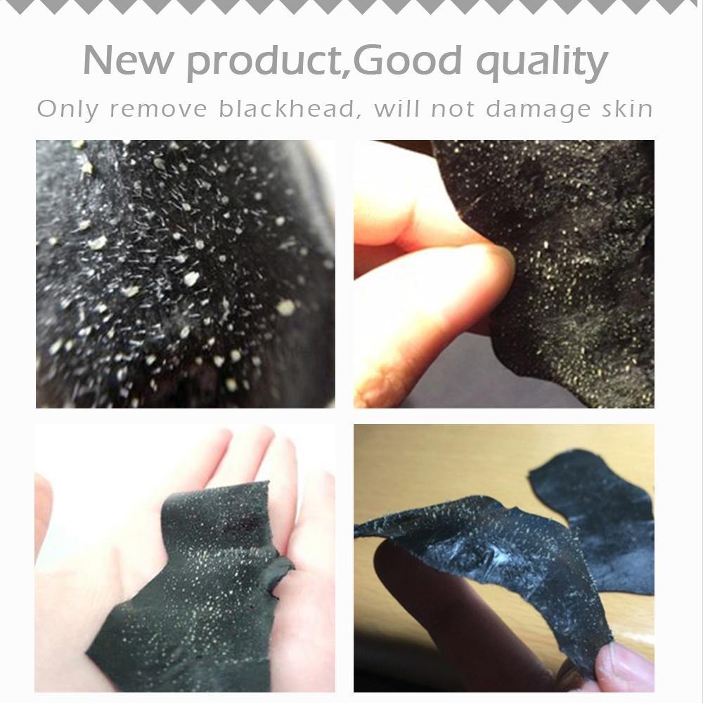 LANBENA Deep Cleansing Nose STrips | Blackhead Buster